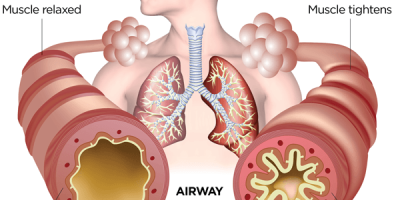 normal-vs-asthma-lung